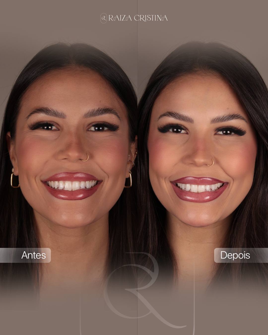 Antes e depois – post do Instagram