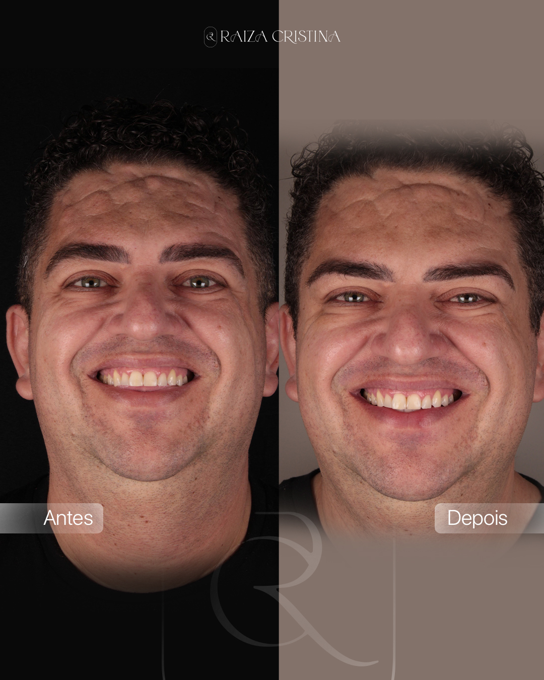 Antes e depois – post do Instagram