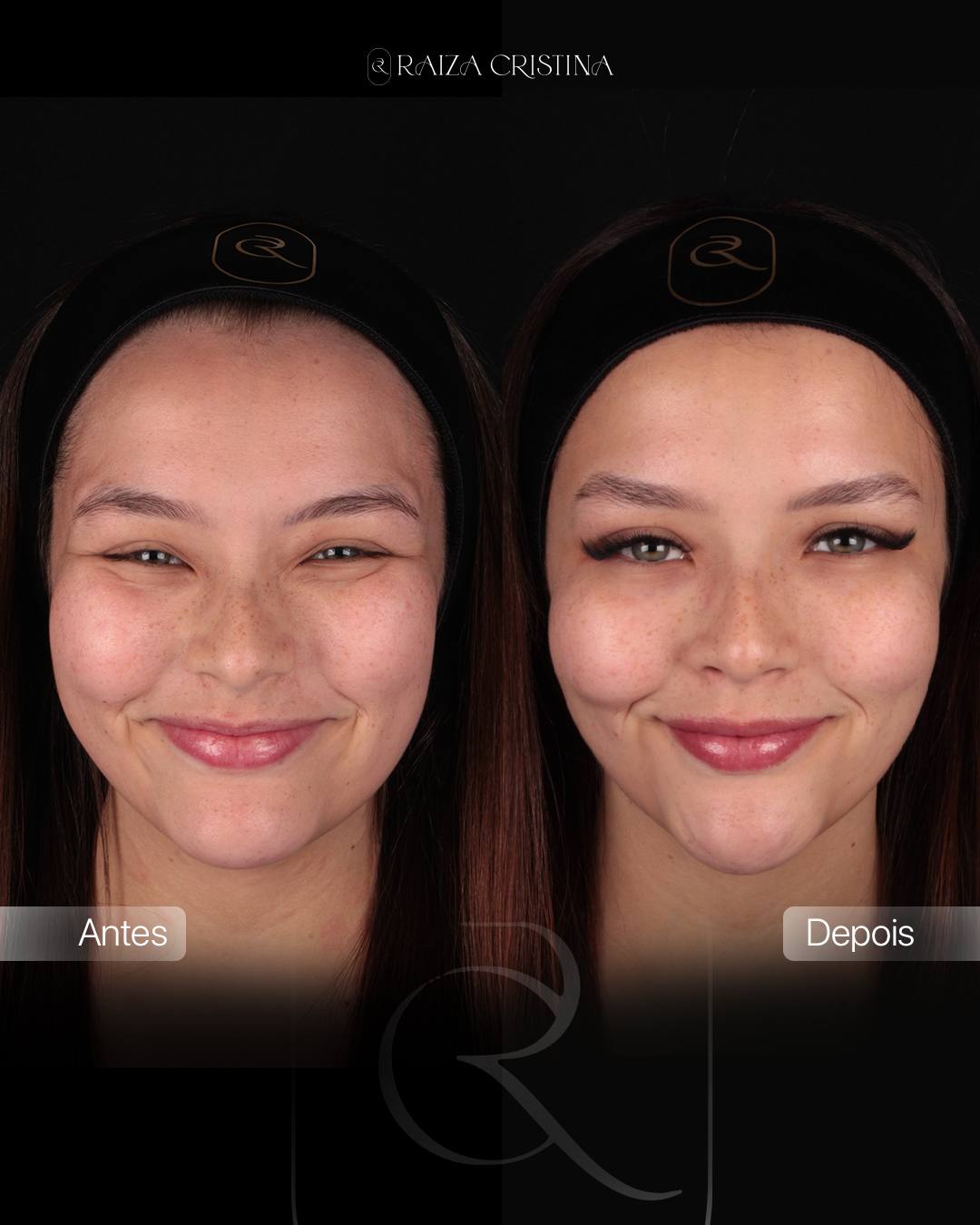 Antes e depois – post do Instagram