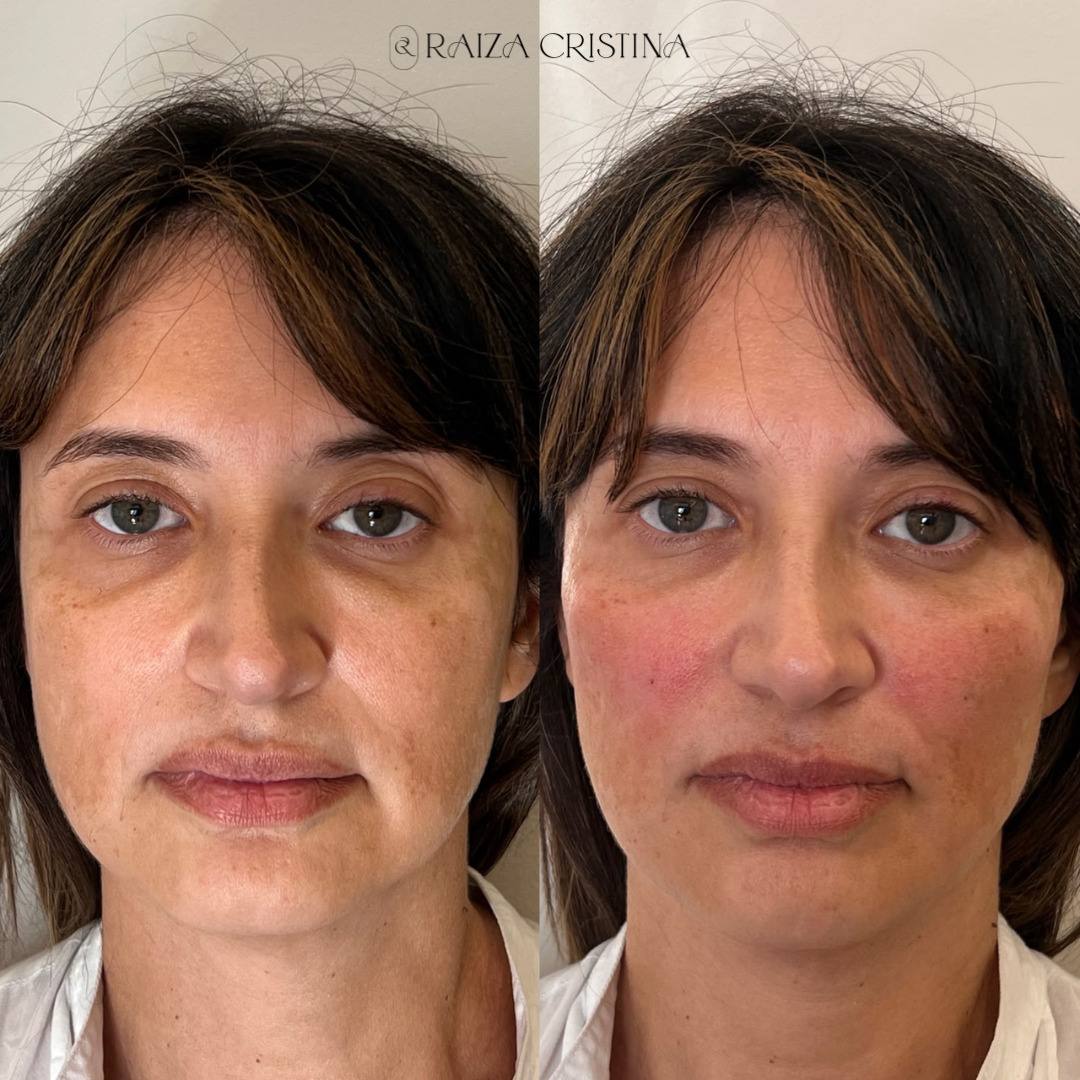 Antes e depois – post do Instagram