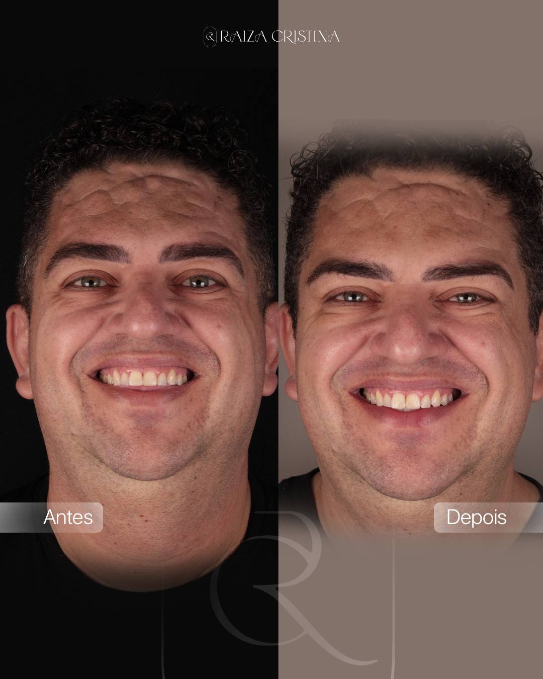 Antes e depois – post do Instagram